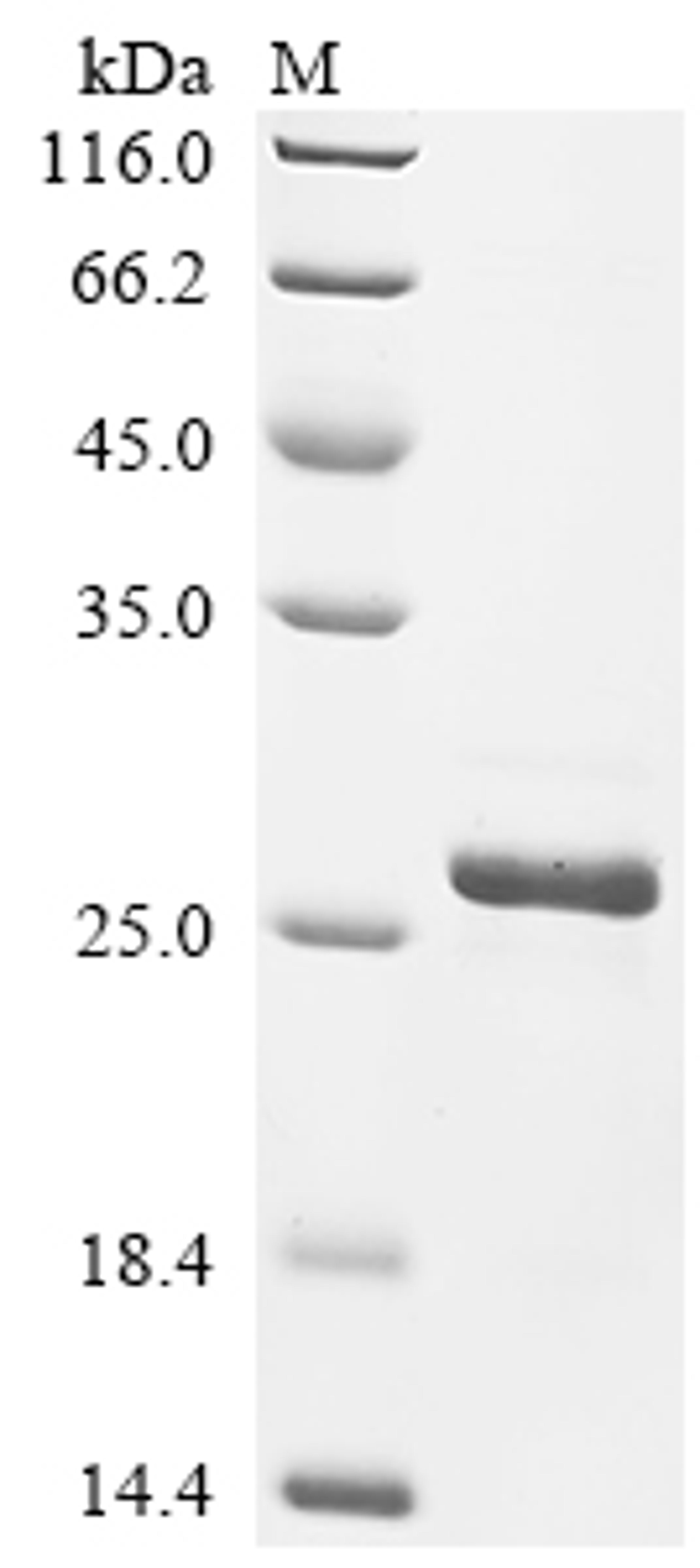 (Tris-Glycine gel) Discontinuous SDS-PAGE (reduced) with 5% enrichment gel and 15% separation gel.