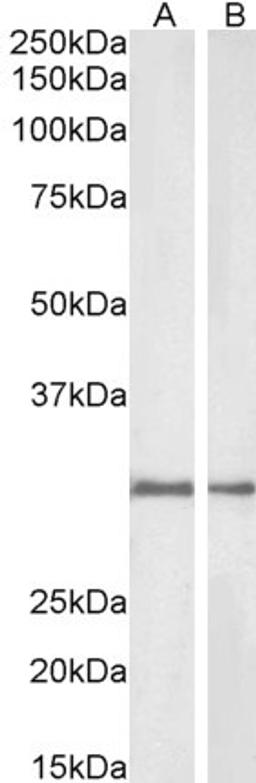 45-981 (1ug/ml) staining of Rat (A) and Pig (B) Kidney lysate (35ug protein in RIPA buffer). Detected by chemiluminescence