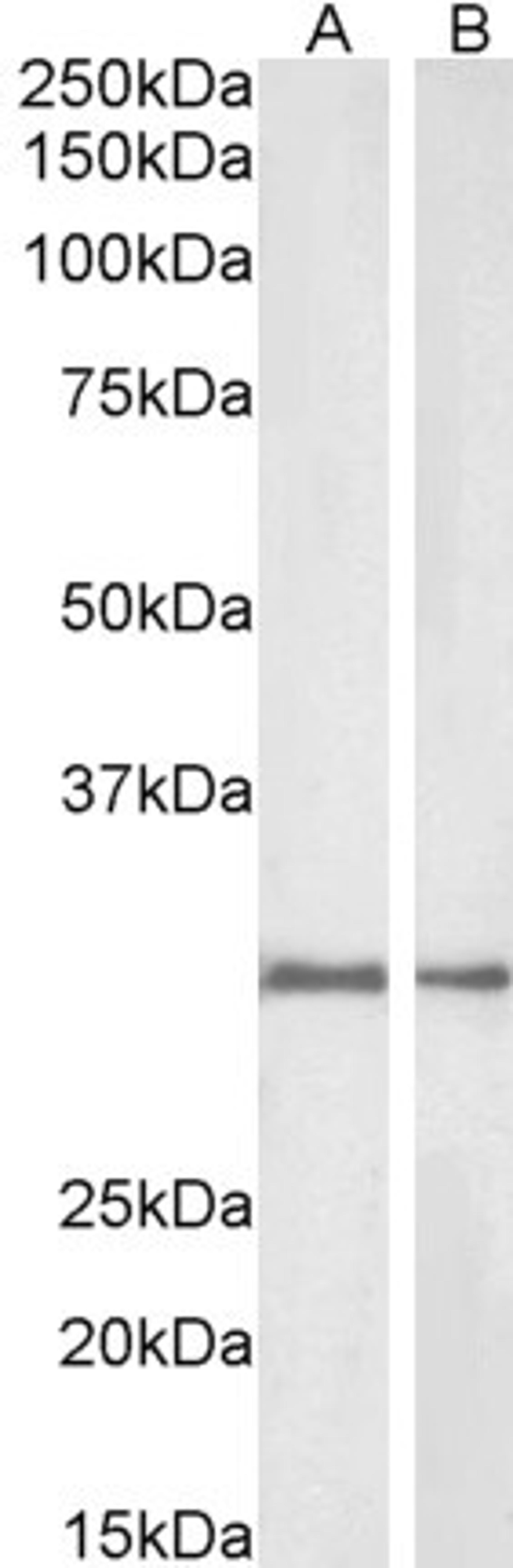 45-981 (1ug/ml) staining of Rat (A) and Pig (B) Kidney lysate (35ug protein in RIPA buffer). Detected by chemiluminescence