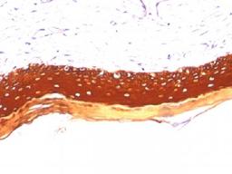 Immunohistochemical staining of human Skin tissue using KRT77 antibody