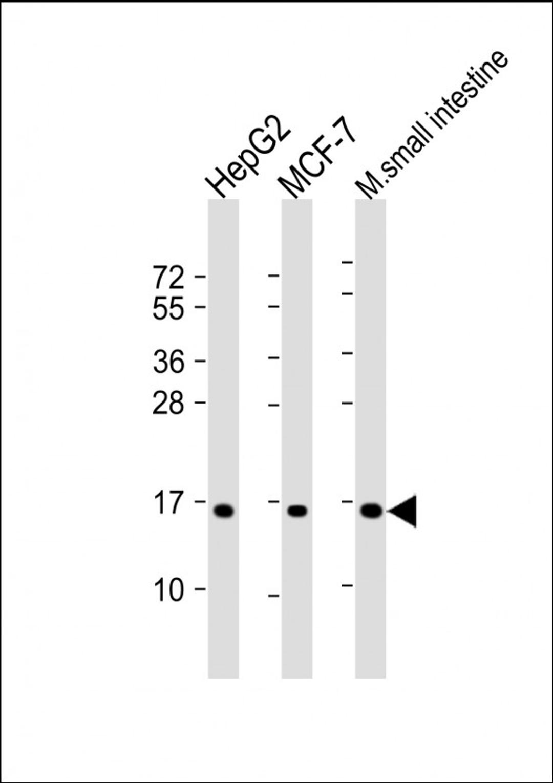 Western Blot at 1:2000 dilution Lane 1: HepG2 whole cell lysate Lane 2: MCF-7 whole cell lysate Lane 3: mouse small intestine lysate Lysates/proteins at 20 ug per lane.