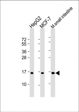 Western Blot at 1:2000 dilution Lane 1: HepG2 whole cell lysate Lane 2: MCF-7 whole cell lysate Lane 3: mouse small intestine lysate Lysates/proteins at 20 ug per lane.