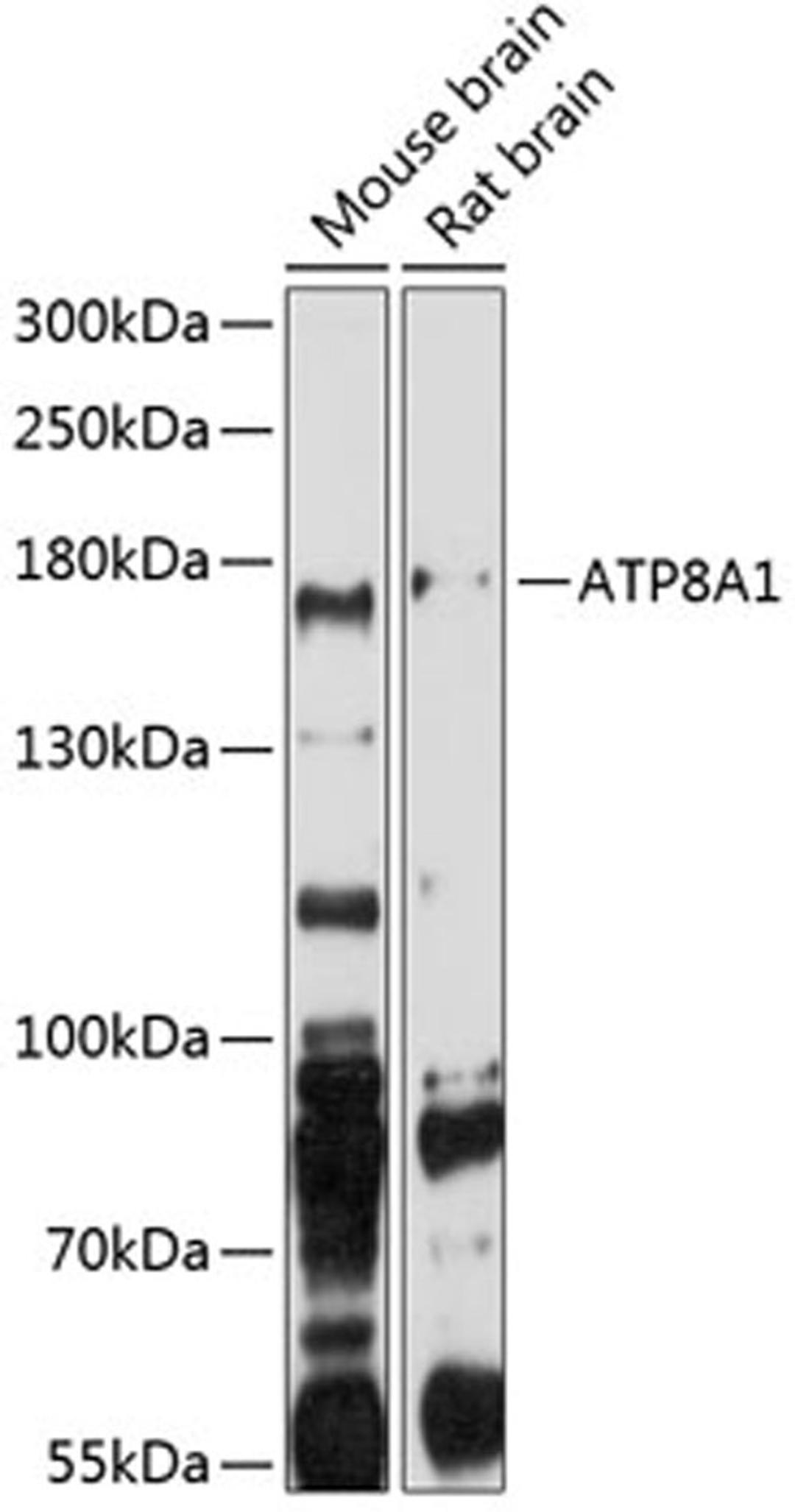 Western blot - ATP8A1 antibody (A3369)