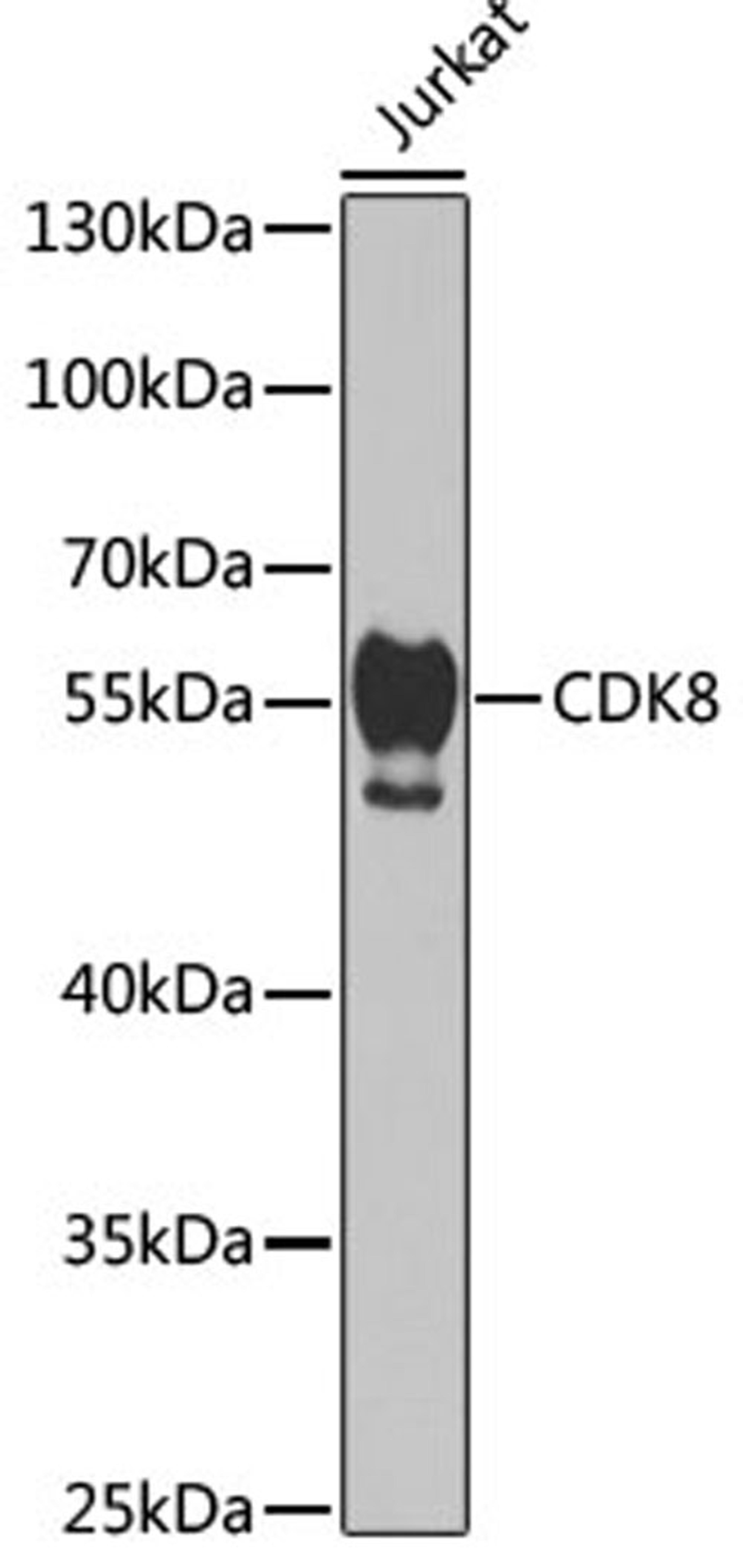 Western blot - CDK8 antibody (A5548)