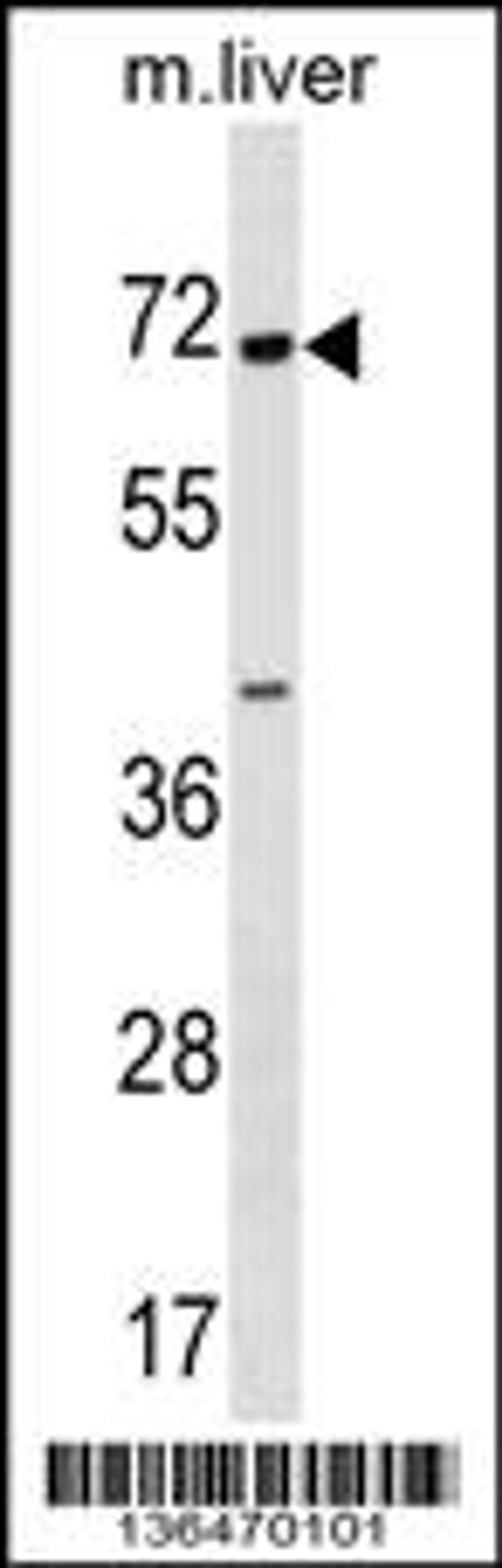 Western blot analysis in mouse liver tissue lysates (35ug/lane).