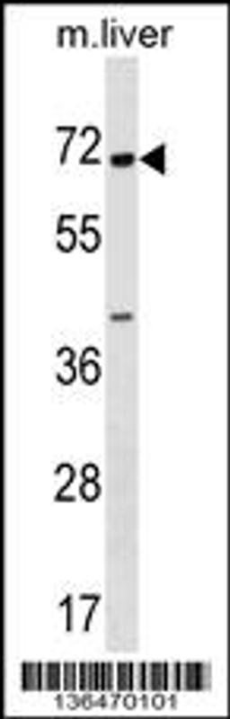 Western blot analysis in mouse liver tissue lysates (35ug/lane).