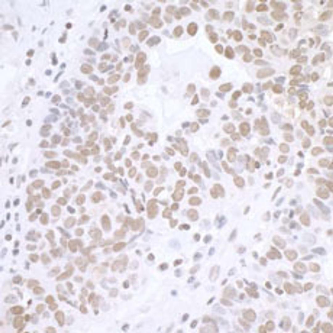 Detection of human BCAS2 by immunohistochemistry.