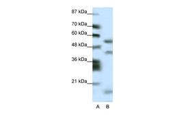 Antibody used in WB on Human HepG2 at 0.2-1 ug/ml.