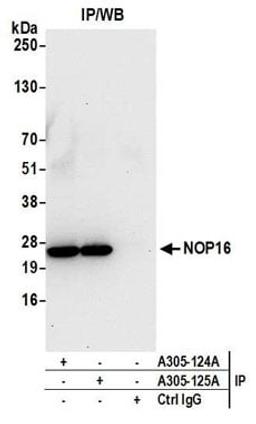 Detection of human NOP16 by western blot of immunoprecipitates.