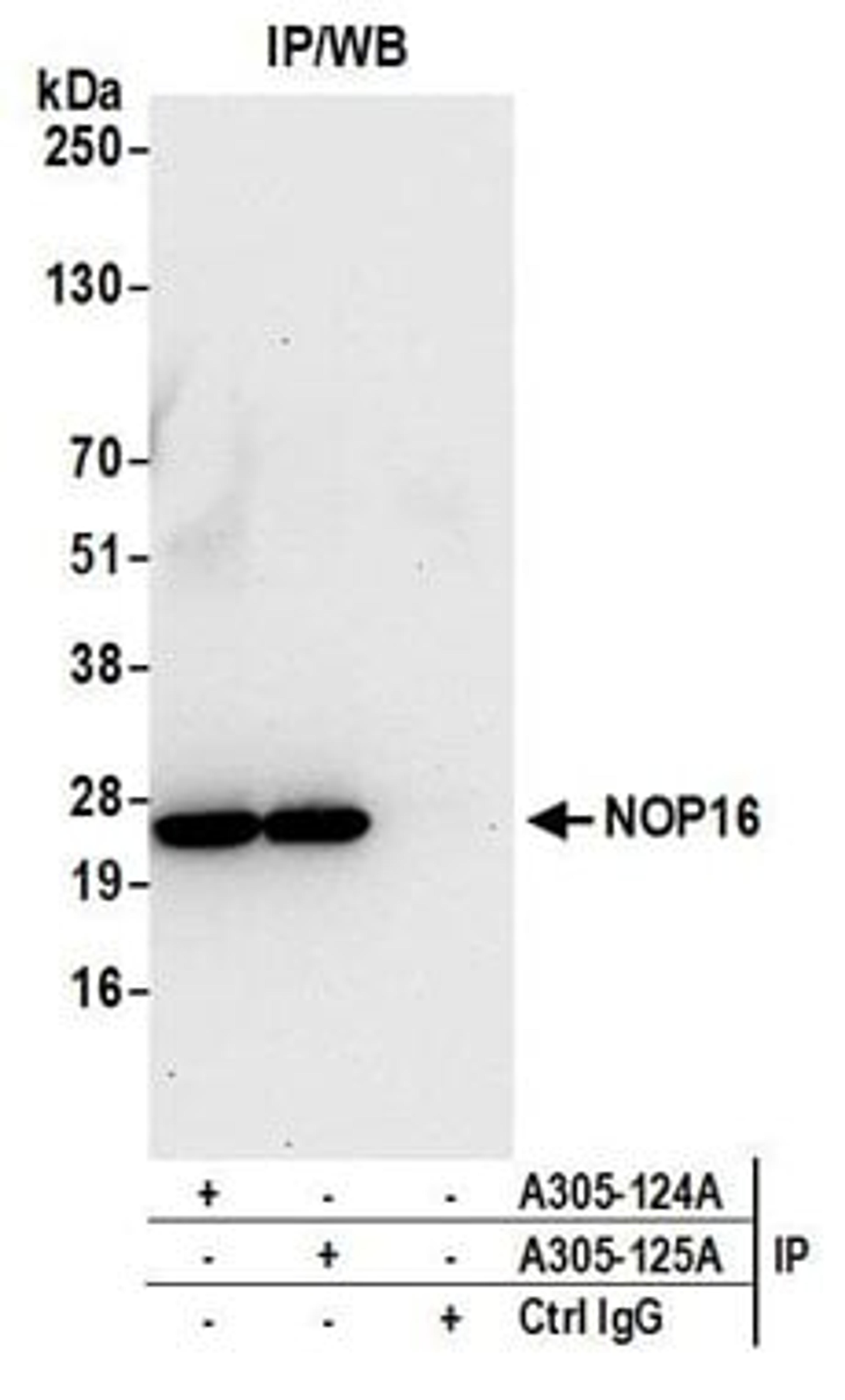 Detection of human NOP16 by western blot of immunoprecipitates.