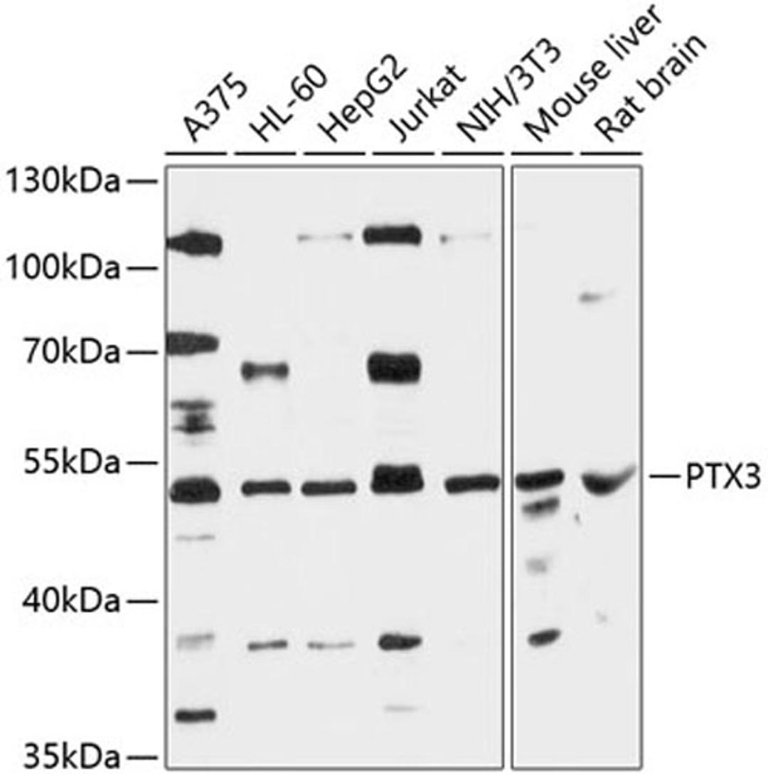 Western blot - PTX3 antibody (A12669)