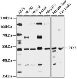 Western blot - PTX3 antibody (A12669)