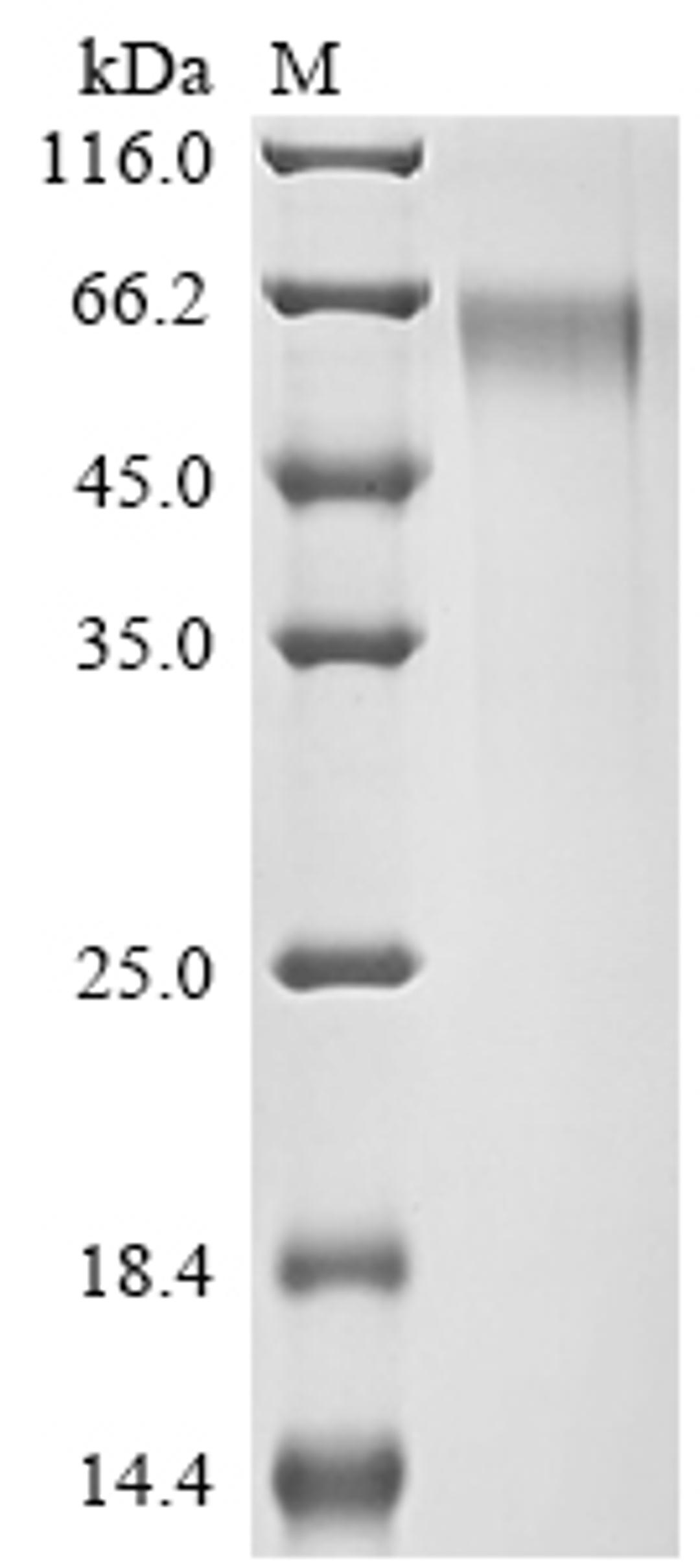 (Tris-Glycine gel) Discontinuous SDS-PAGE (reduced) with 5% enrichment gel and 15% separation gel.