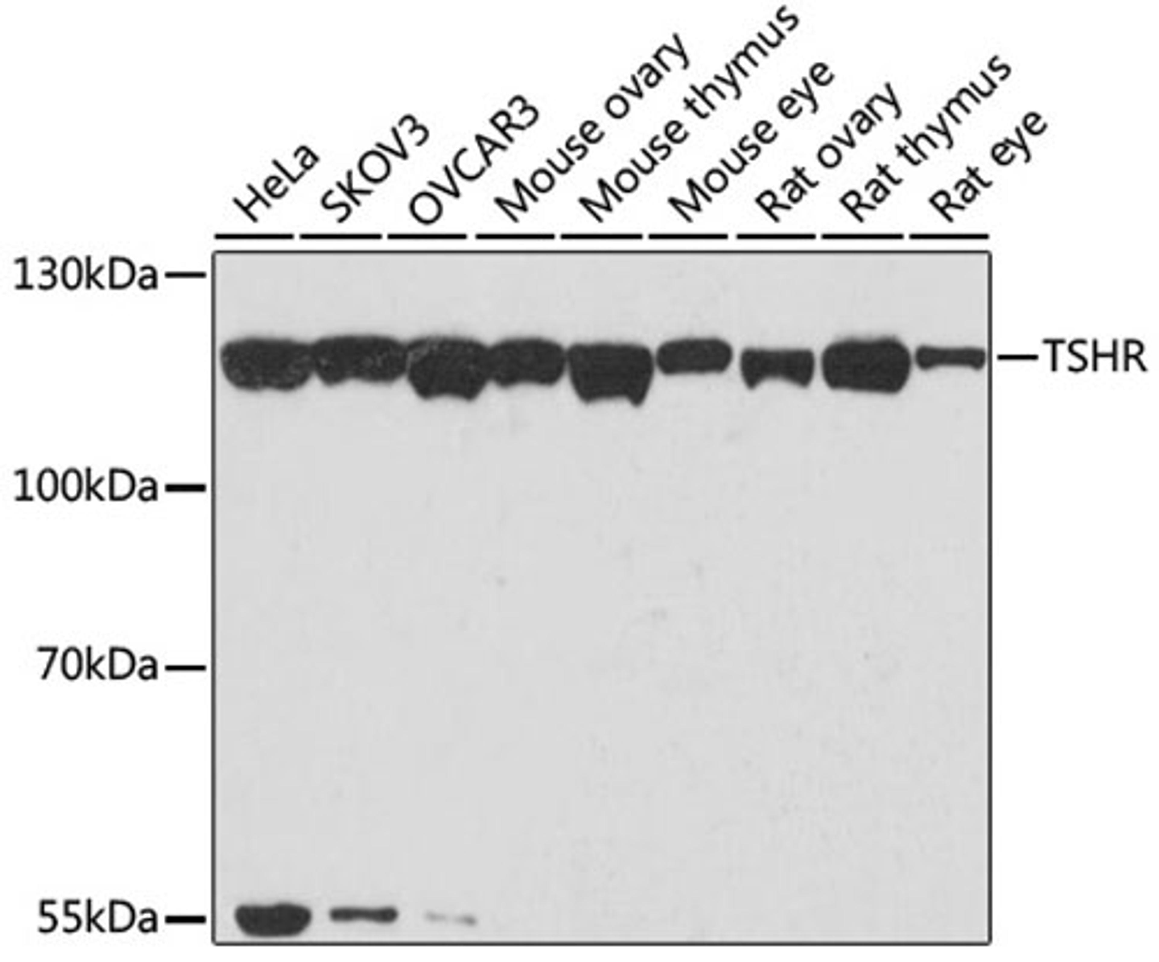 Western blot - TSHR antibody (A6781)