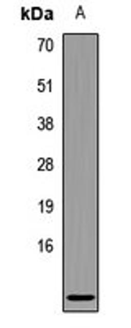 Western blot analysis of Bcell (Lane1) whole cell lysates using CCL3L3 antibody