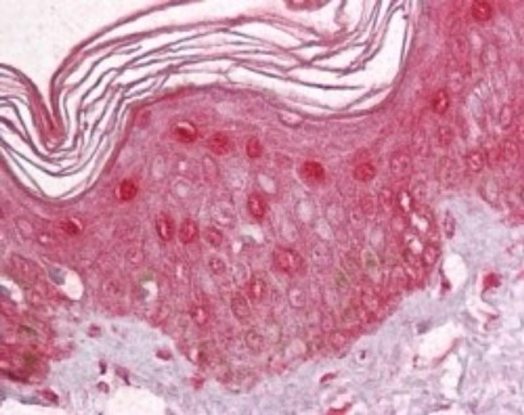 Immunohistochemistry-Paraffin: Pokemon Antibody [NBP2-23673] - IHC analysis of human skin using Pokemon antibody at 1:100.