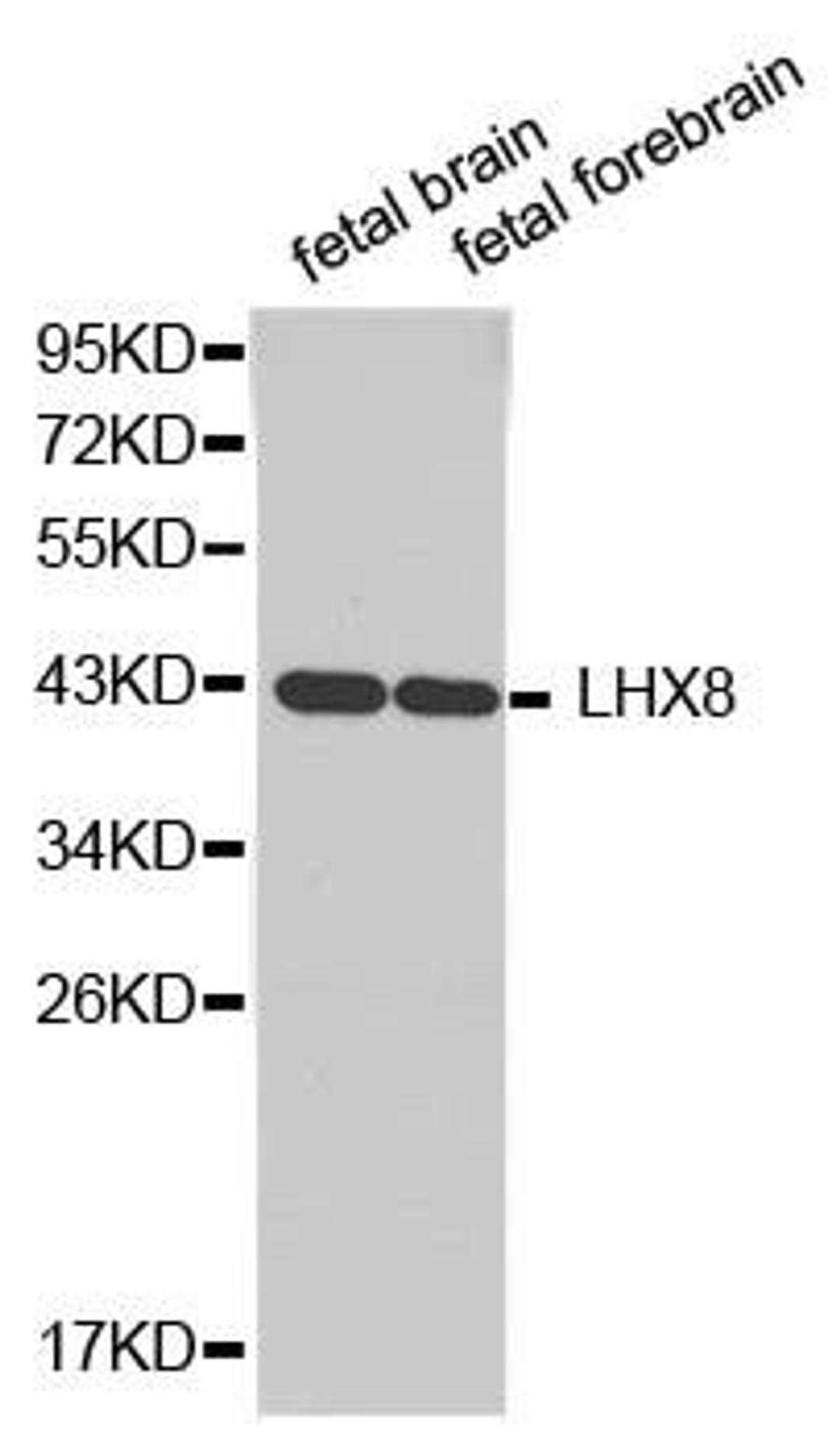 Western blot analysis of extracts of various cell lines using LHX8 antibody