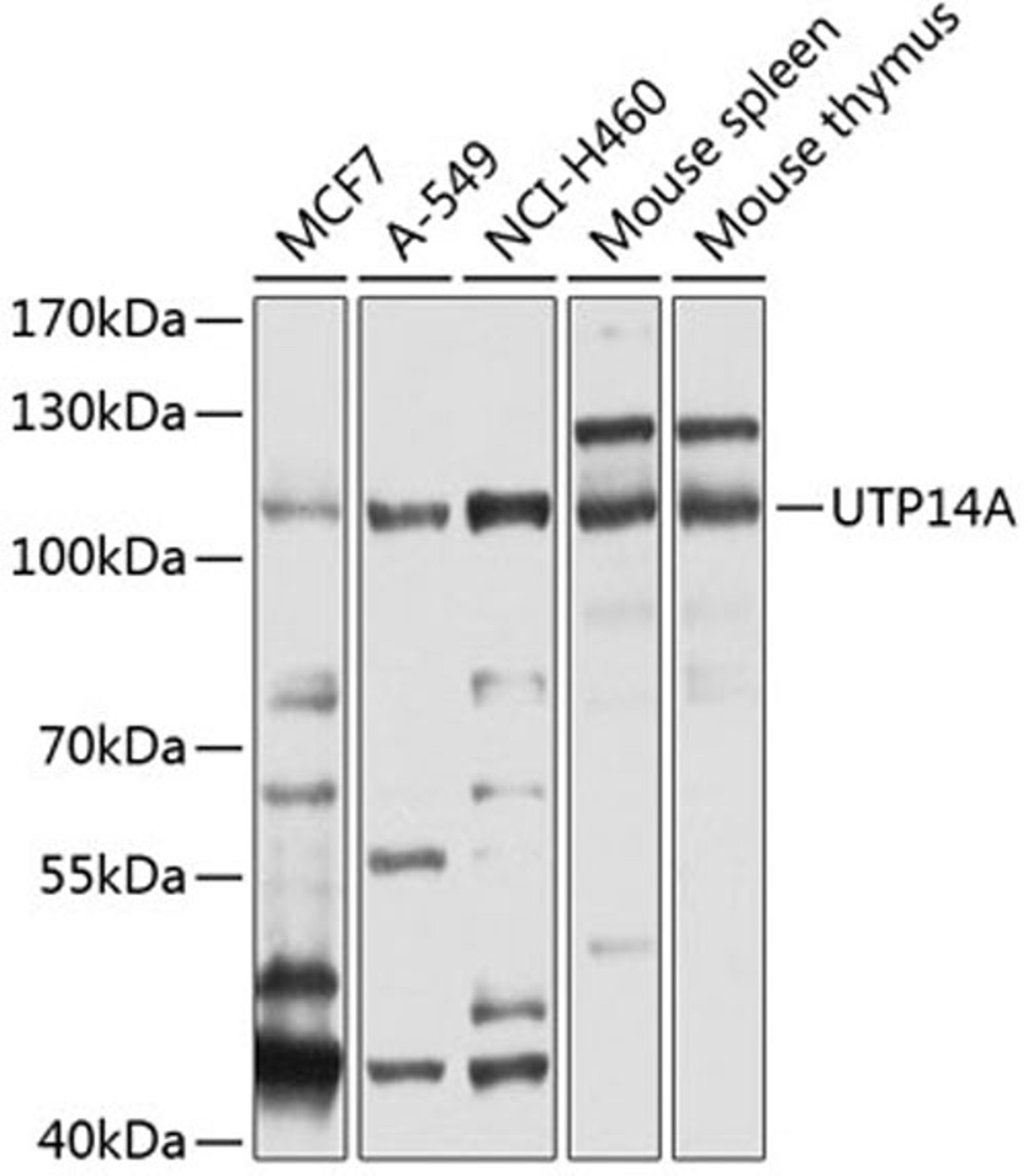 Western blot - UTP14A antibody (A5960)