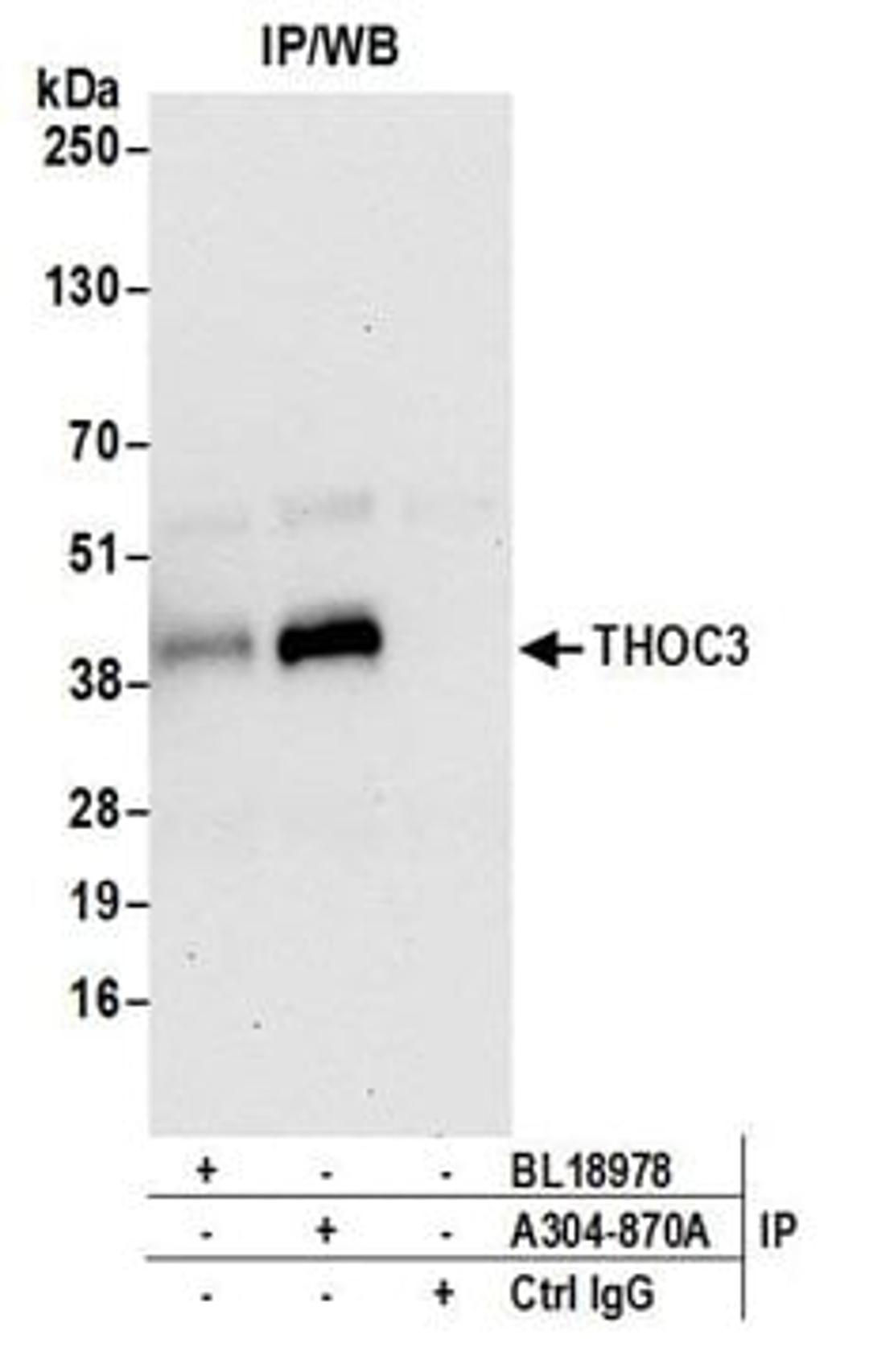 Detection of human THOC3 by western blot of immunoprecipitates.