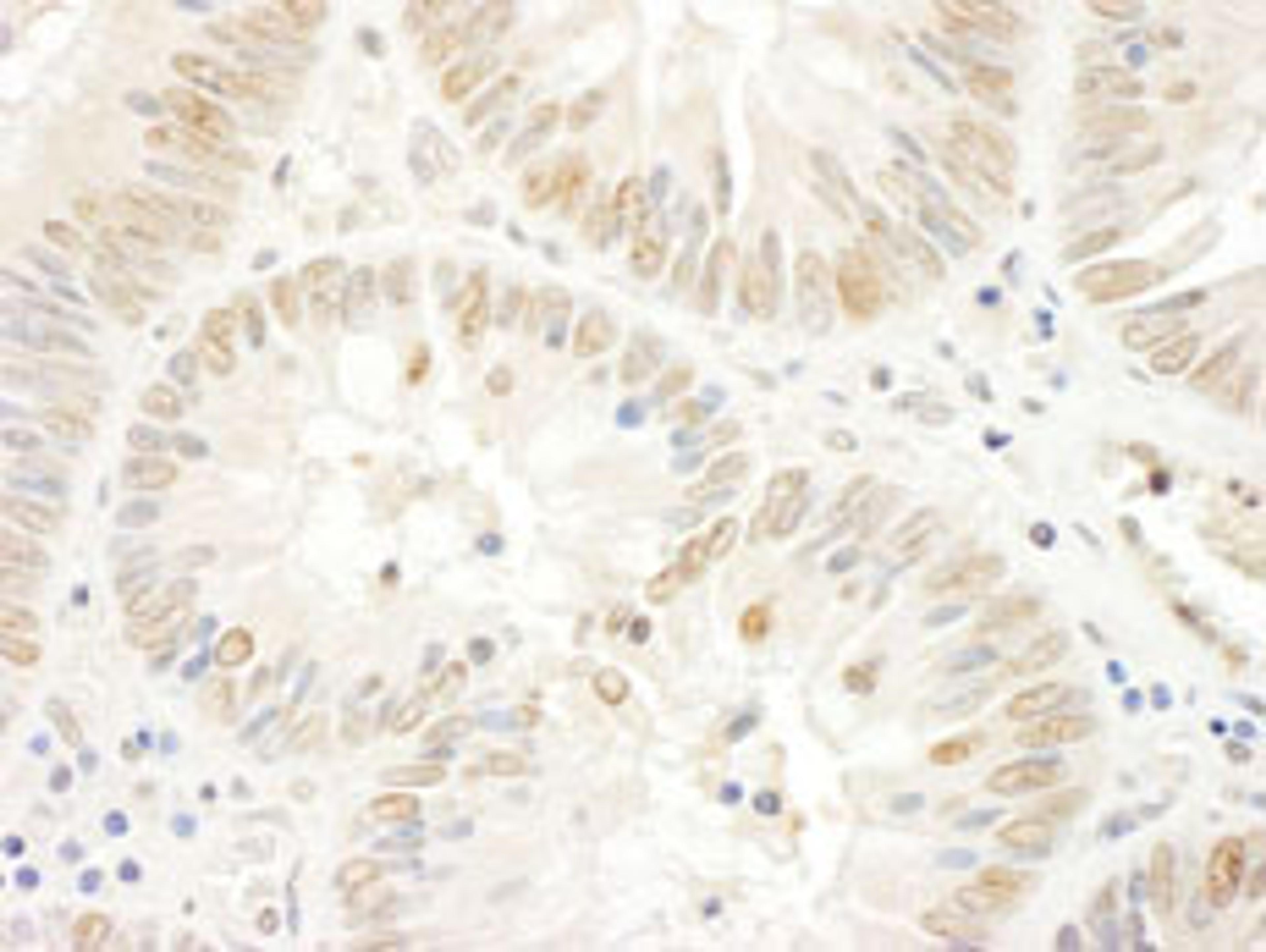 Detection of human NOPP140 by immunohistochemistry.