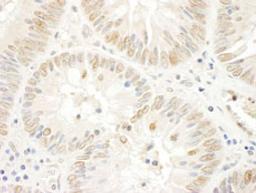 Detection of human NOPP140 by immunohistochemistry.