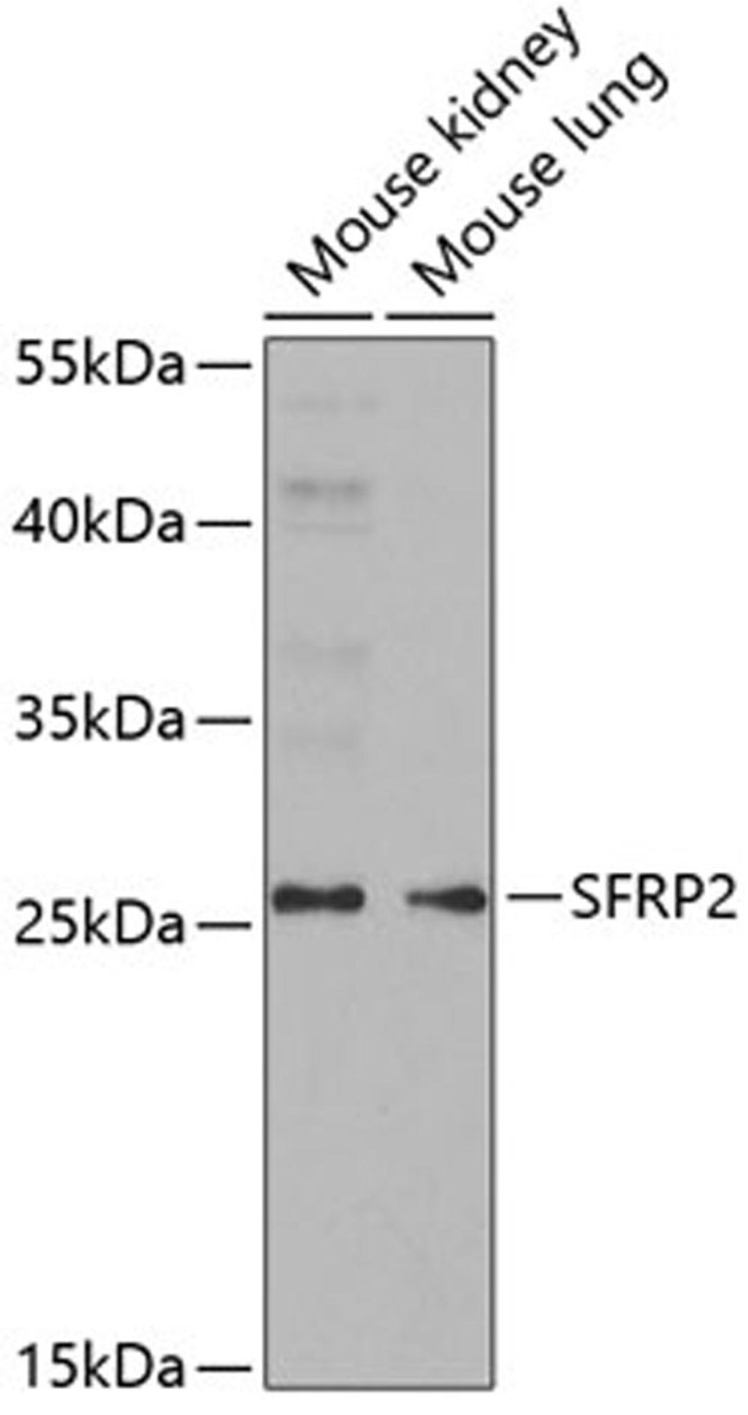 Western blot - SFRP2 antibody (A5383)