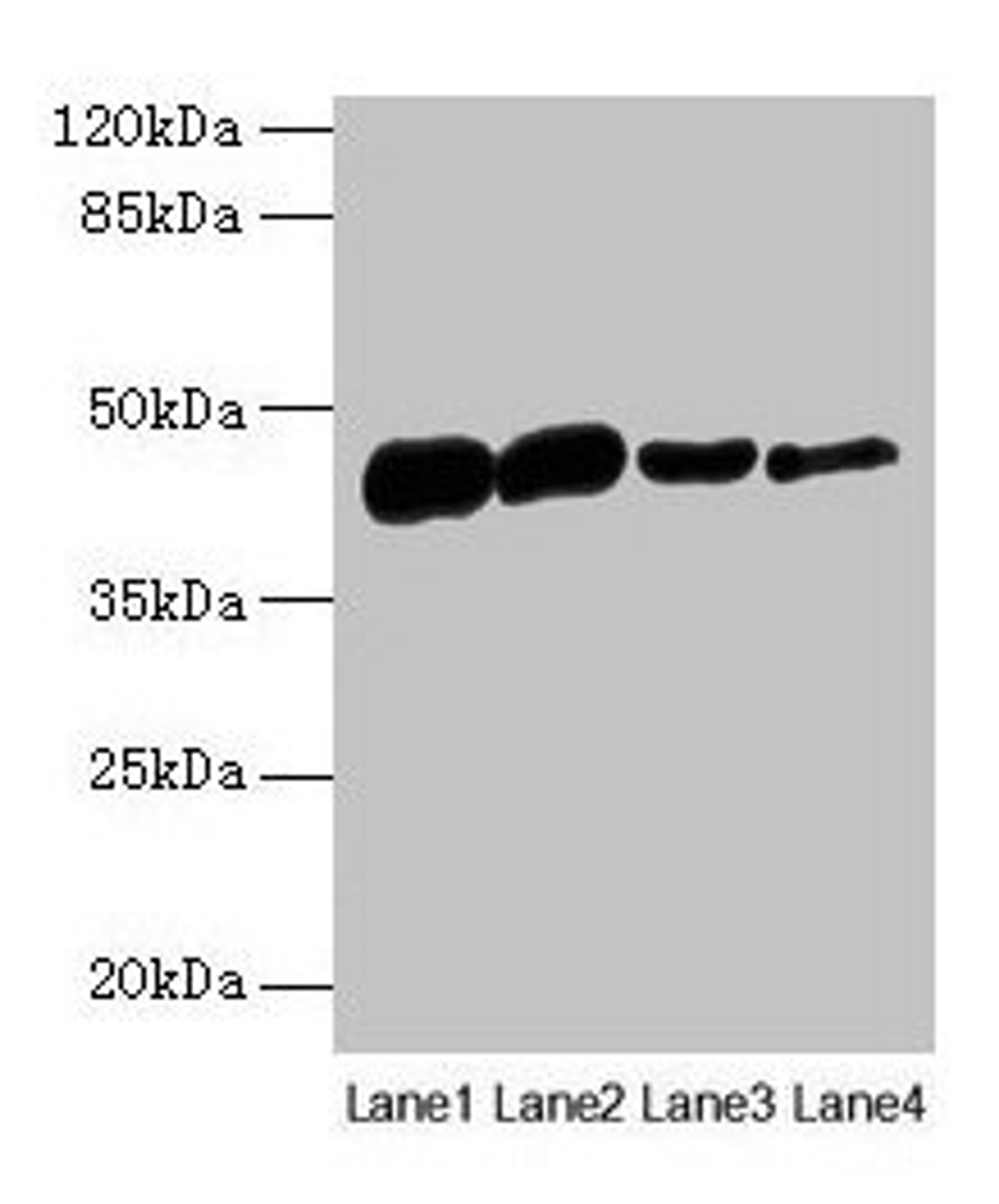 Western blot. All lanes: ACTA1 antibody at 16µg/ml. Lane 1: Rat heart tissue. Lane 2: Mouse skeletal muscle tissue. Lane 3: Human placenta tissue. Lane 4: CEM whole cell lysate. Secondary. Goat polyclonal to rabbit IgG at 1/10000 dilution. Predicted band size: 43 kDa. Observed band size: 43 kDa