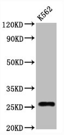 Western Blot. Positive WB detected in:K562 whole cell lysate. All lanes:CD81 antibody at 1.25μg/ml. Secondary. Goat polyclonal to rabbit IgG at 1/50000 dilution. Predicted band size: 26 KDa. Observed band size: 26 KDa