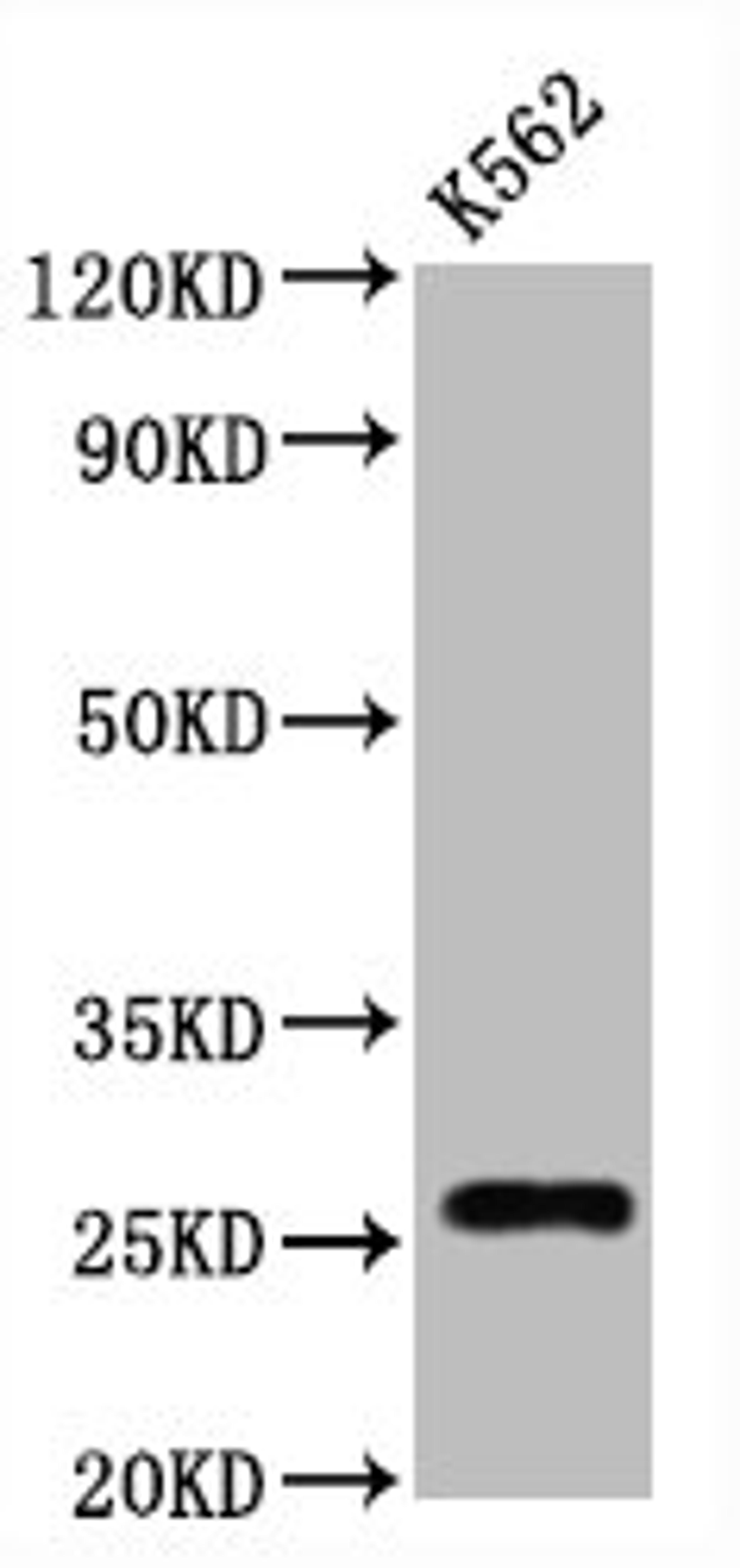 Western Blot. Positive WB detected in:K562 whole cell lysate. All lanes:CD81 antibody at 1.25μg/ml. Secondary. Goat polyclonal to rabbit IgG at 1/50000 dilution. Predicted band size: 26 KDa. Observed band size: 26 KDa