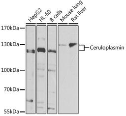 Western blot - Ceruloplasmin Antibody (A7658)