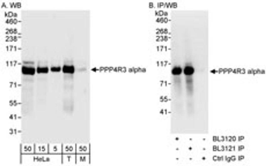 Detection of human PPP4R3 Alpha by western blot (h&m) and immunoprecipitation (h).