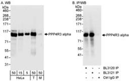 Detection of human PPP4R3 Alpha by western blot (h&m) and immunoprecipitation (h).