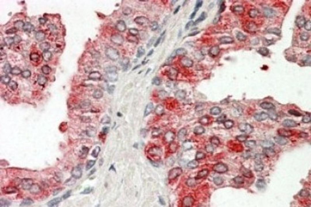 Immunohistochemistry-Paraffin: Prostatic Acid Phosphatase Antibody [NBP1-51946] - (3.8ug/ml) staining of paraffin embedded Human Prostate. Steamed antigen retrieval with citrate buffer pH 6, AP-staining.