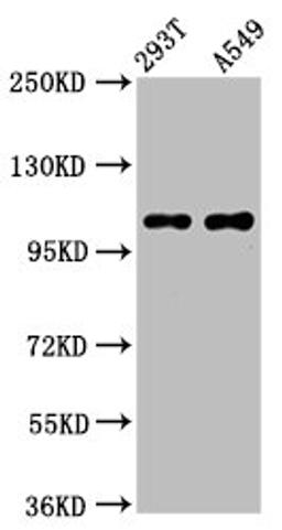 Western Blot. Positive WB detected in: 293T whole cell lysate, A549 whole cell lysate. All lanes: ICE2 antibody at 4.1µg/ml. Secondary. Goat polyclonal to rabbit IgG at 1/50000 dilution. Predicted band size: 111, 9 kDa. Observed band size: 111 kDa