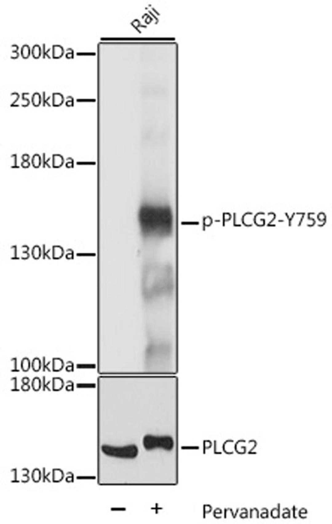 Western blot - Phospho-PLCG2-Y759 antibody (AP0785)