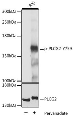 Western blot - Phospho-PLCG2-Y759 antibody (AP0785)