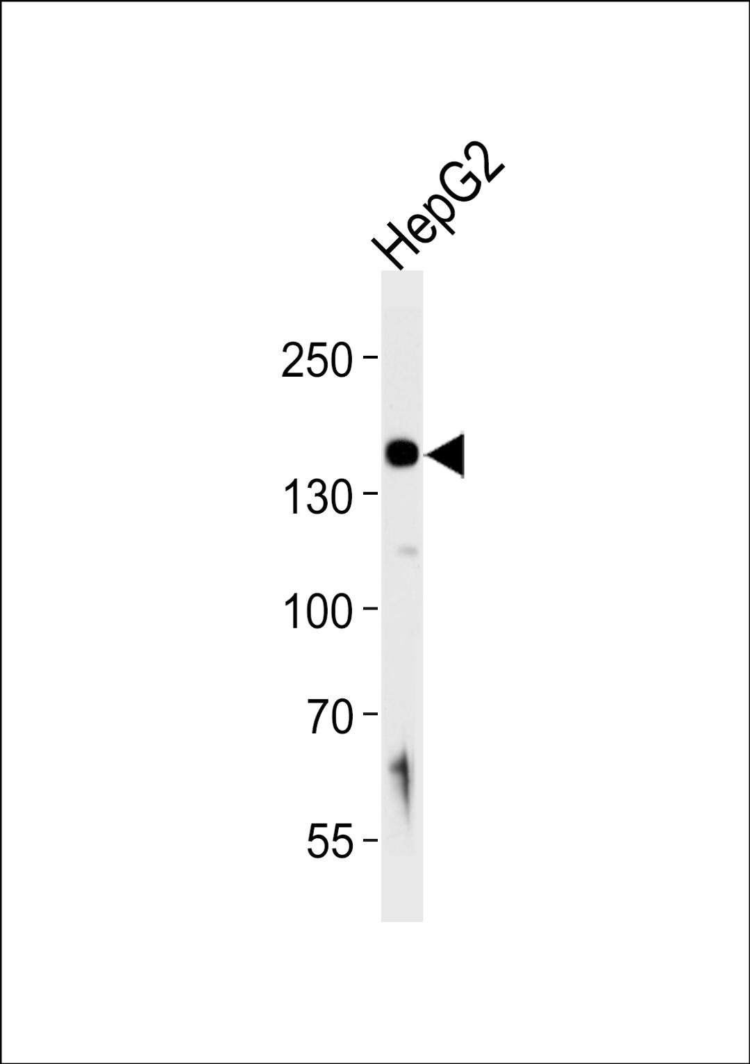 Western blot analysis of lysate from HepG2 cell line, using HYOU1 Antibody at 1:1000 at each lane.