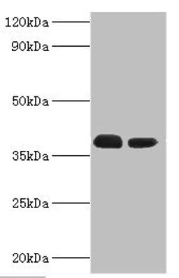 Western blot. All lanes: Three-prime repair exonuclease 1 antibody at 3µg/ml. Lane 1: Hela whole cell lysate. Lane 2: HepG2 whole cell lysate. Secondary. Goat polyclonal to rabbit IgG at 1/10000 dilution. Predicted band size: 39, 33, 34 kDa. Observed band size: 39 kDa