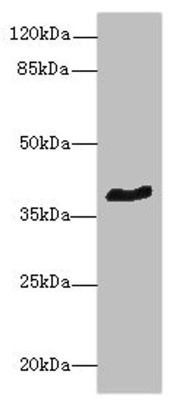 Western blot. All lanes: GPR18 antibody at 8µg/ml + Mouse brain tissue. Secondary. Goat polyclonal to rabbit IgG at 1/10000 dilution. Predicted band size: 39 kDa. Observed band size: 39 kDa