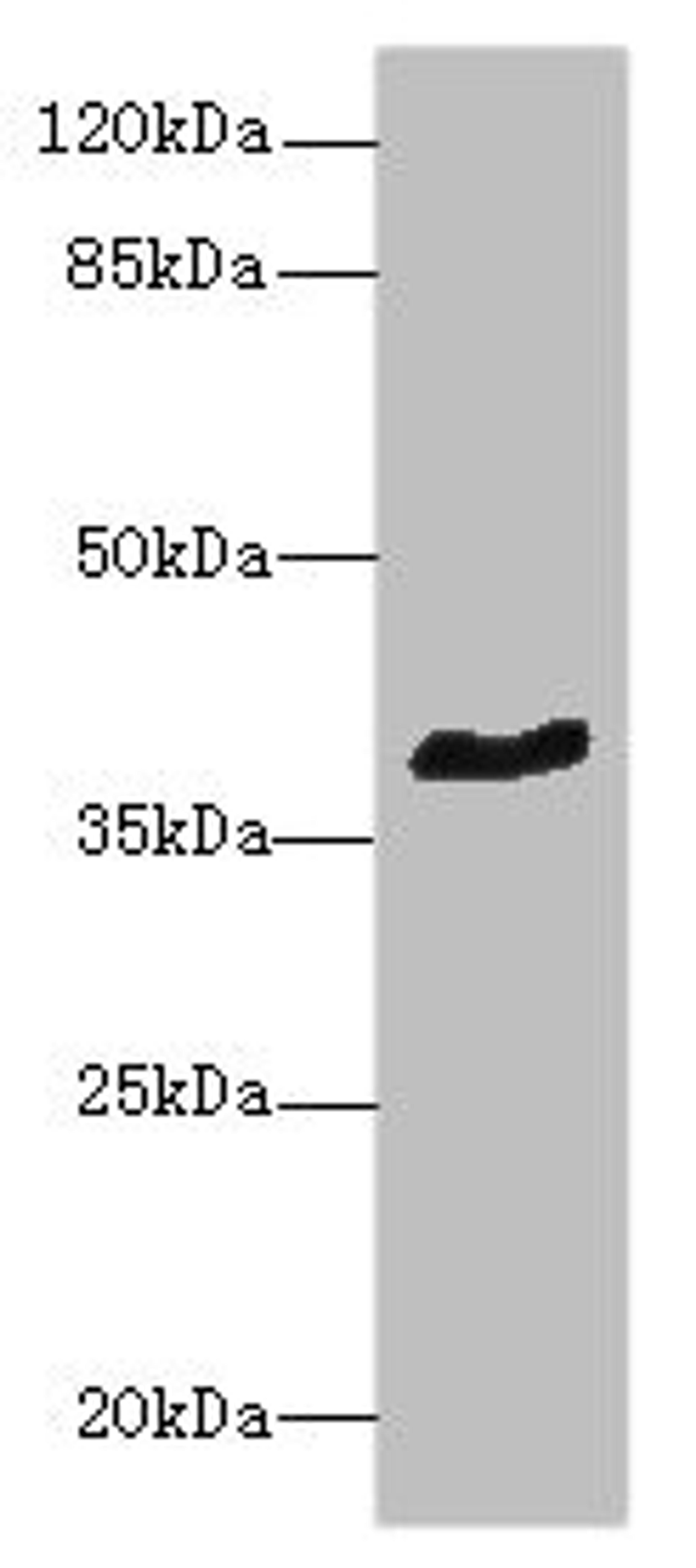 Western blot. All lanes: GPR18 antibody at 8µg/ml + Mouse brain tissue. Secondary. Goat polyclonal to rabbit IgG at 1/10000 dilution. Predicted band size: 39 kDa. Observed band size: 39 kDa