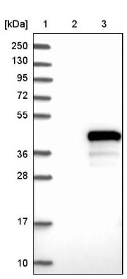 Western Blot: FAM45A Antibody [NBP1-86232] - Lane 1: Marker [kDa] 250, 130, 95, 72, 55, 36, 28, 17, 10<br/>Lane 2: Negative control (vector only transfected HEK293T lysate)<br/>Lane 3: Over-expression lysate (Co-expressed with a C-terminal myc-DDK tag (~3.1 kDa) in mammalian HEK293T cells, LY404132)