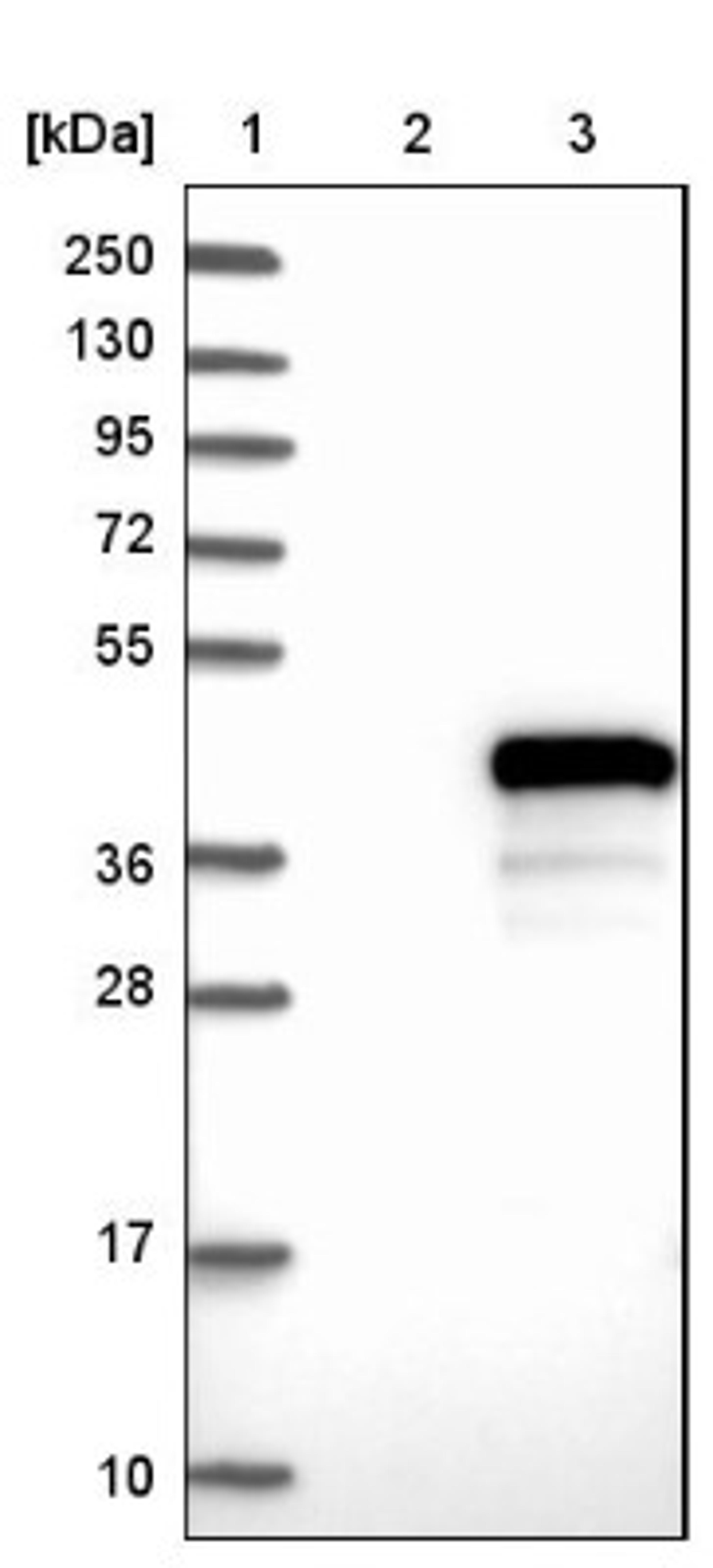 Western Blot: FAM45A Antibody [NBP1-86232] - Lane 1: Marker [kDa] 250, 130, 95, 72, 55, 36, 28, 17, 10<br/>Lane 2: Negative control (vector only transfected HEK293T lysate)<br/>Lane 3: Over-expression lysate (Co-expressed with a C-terminal myc-DDK tag (~3.1 kDa) in mammalian HEK293T cells, LY404132)