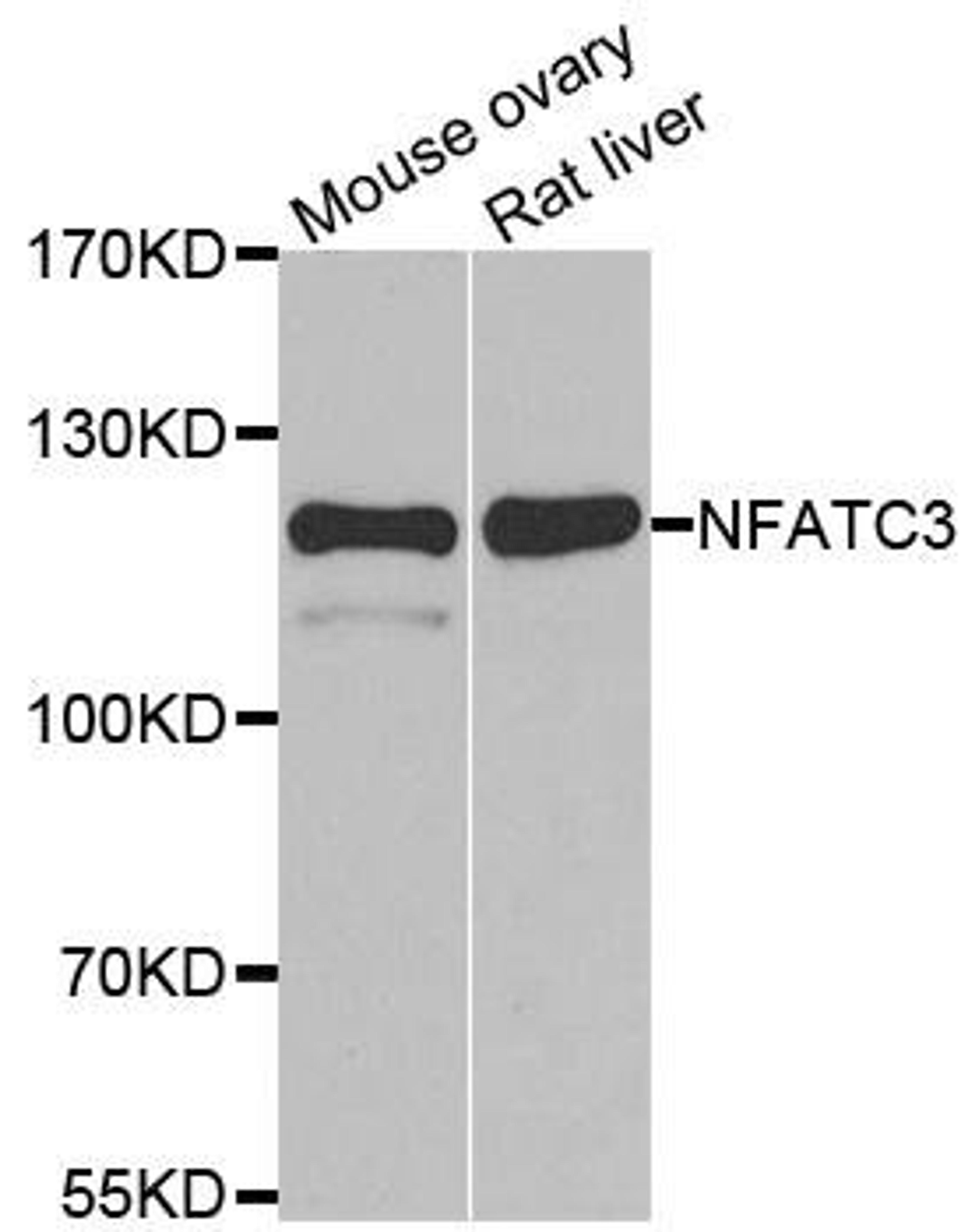 Western blot analysis of extracts of various cell lines using NFATC3 antibody