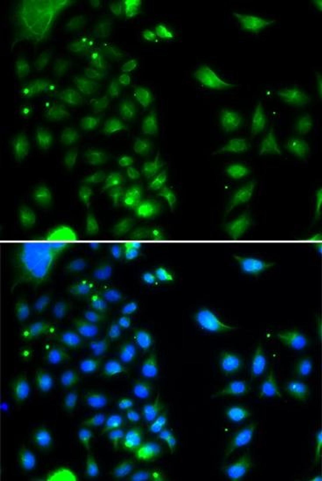 Immunofluorescense analysis of MCF7 cell using UBE2J2 antibody