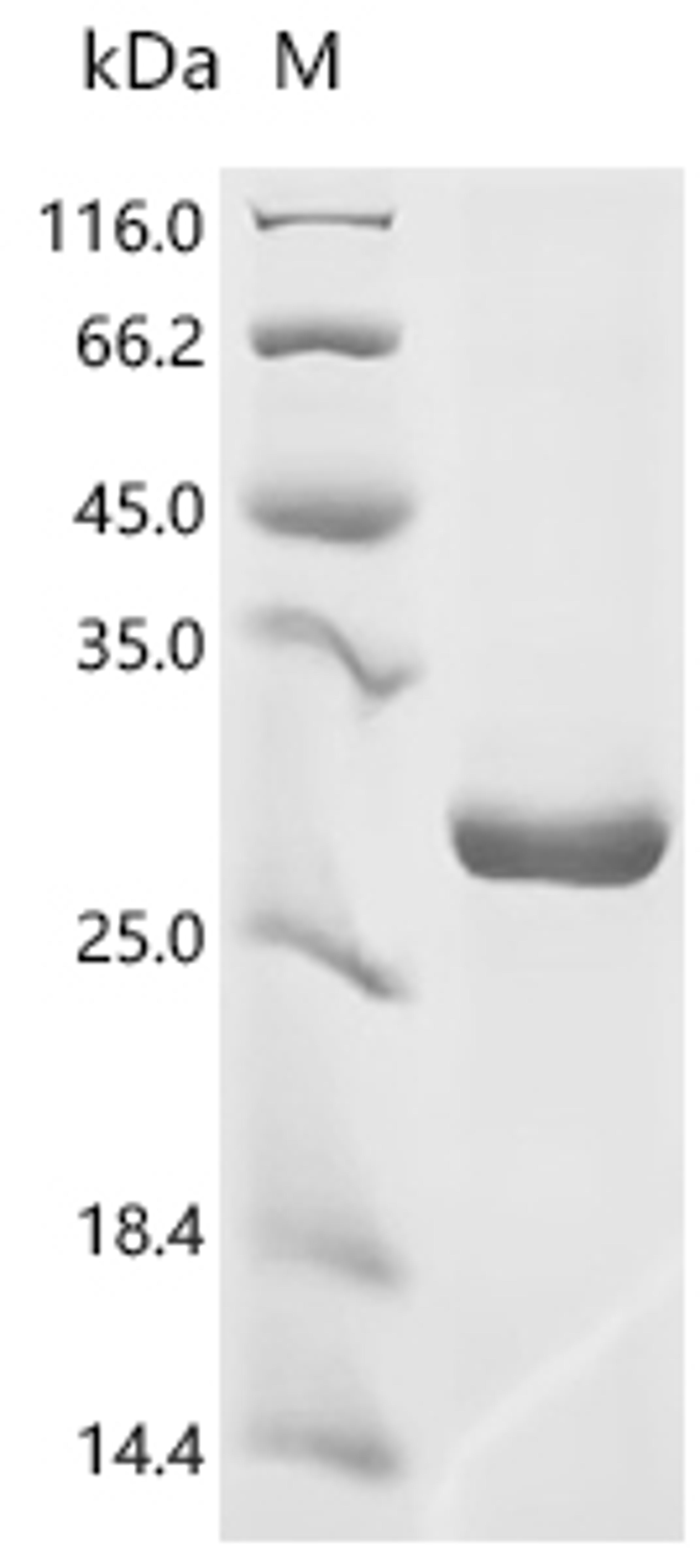 (Tris-Glycine gel) Discontinuous SDS-PAGE (reduced) with 5% enrichment gel and 15% separation gel.