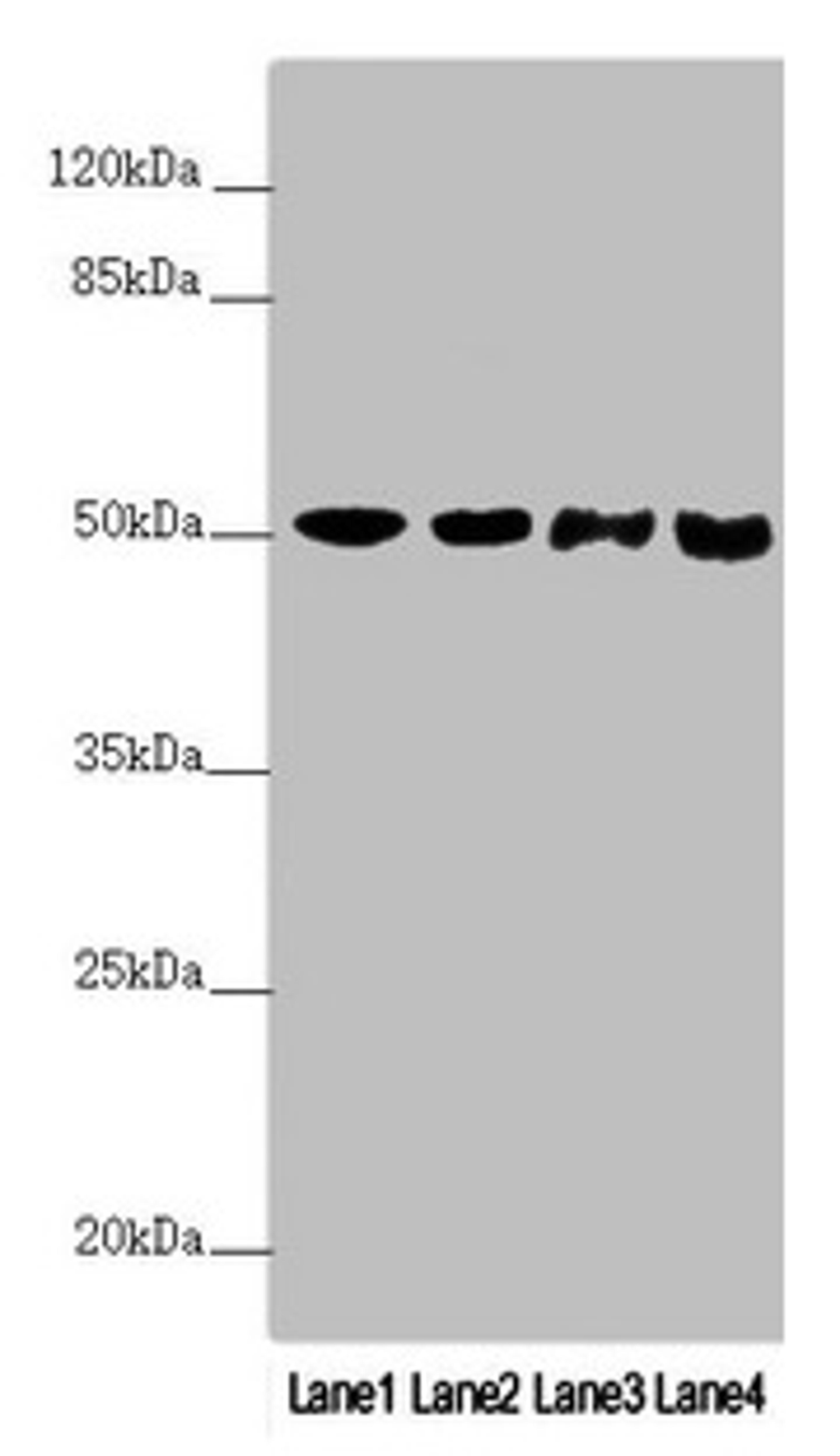 Western blot. All lanes: PPP2R3C antibody at 3.76µg/ml. Lane 1: Mouse stomach tissue. Lane 2: A431 whole cell lysate. Lane 3: Jurkat whole cell lysate. Lane 4: A549 whole cell lysate. Secondary. Goat polyclonal to rabbit IgG at 1/10000 dilution. Predicted band size: 54, 40 kDa. Observed band size: 54 kDa