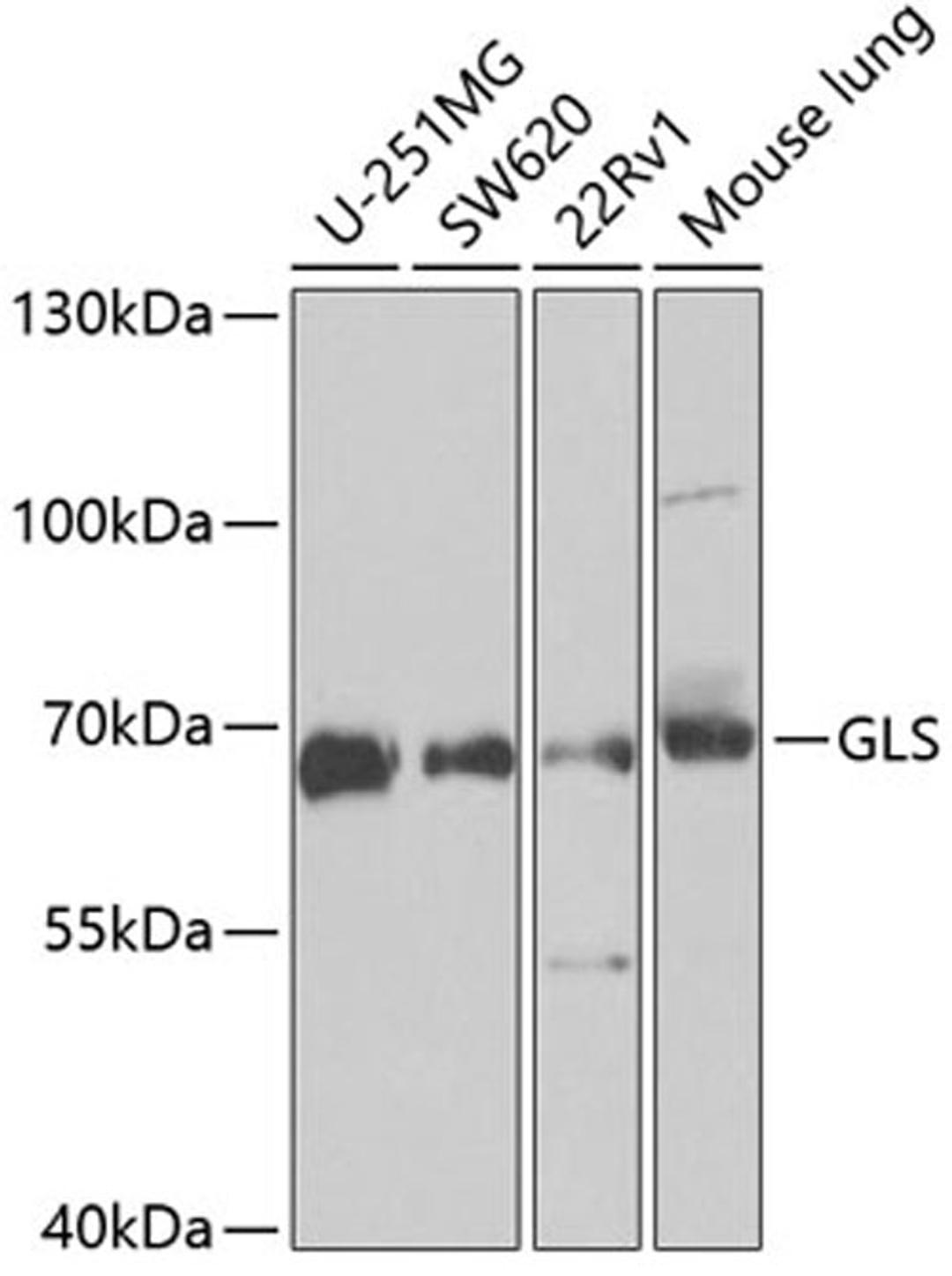 Western blot - GLS antibody (A3885)