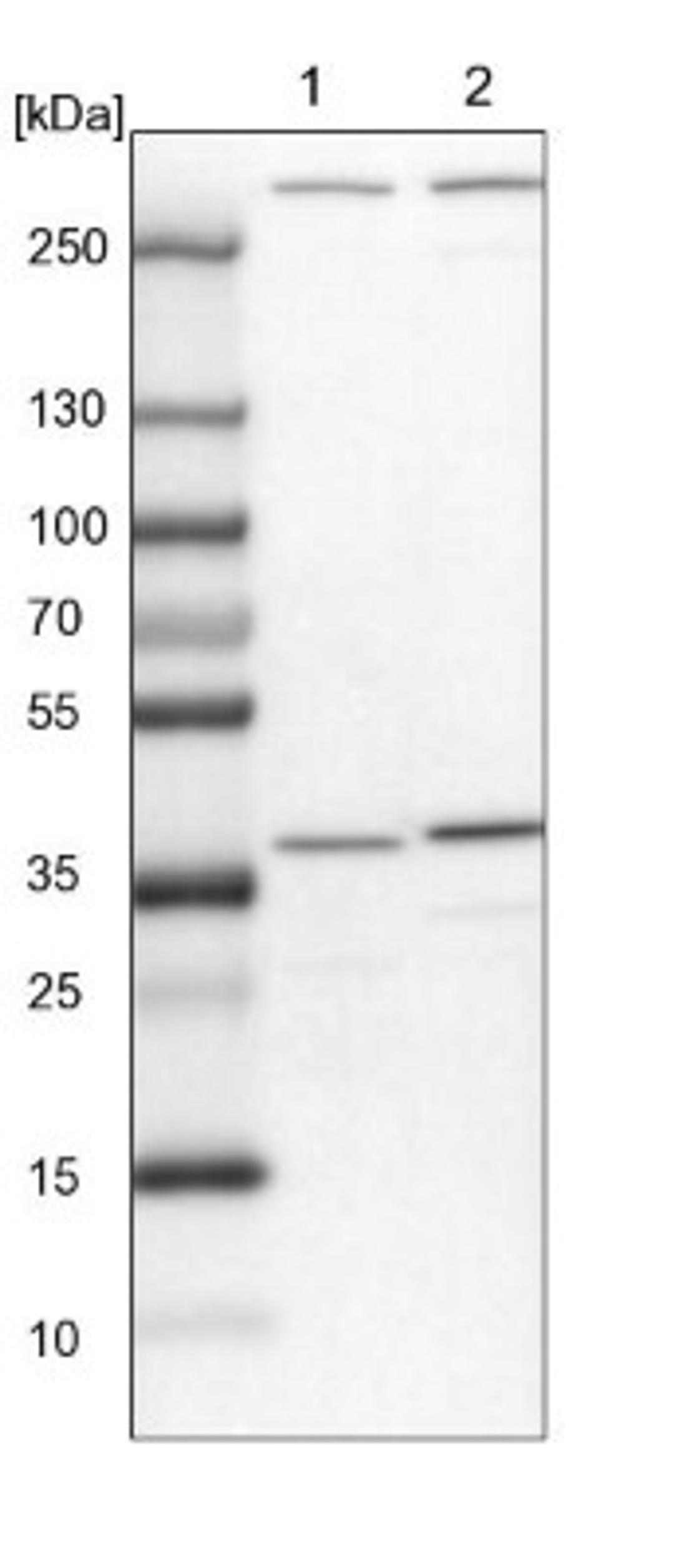 Western Blot: SNX11 Antibody [NBP1-85825] - Lane 1: NIH-3T3 cell lysate (Mouse embryonic fibroblast cells)<br/>Lane 2: NBT-II cell lysate (Rat Wistar bladder tumour cells)