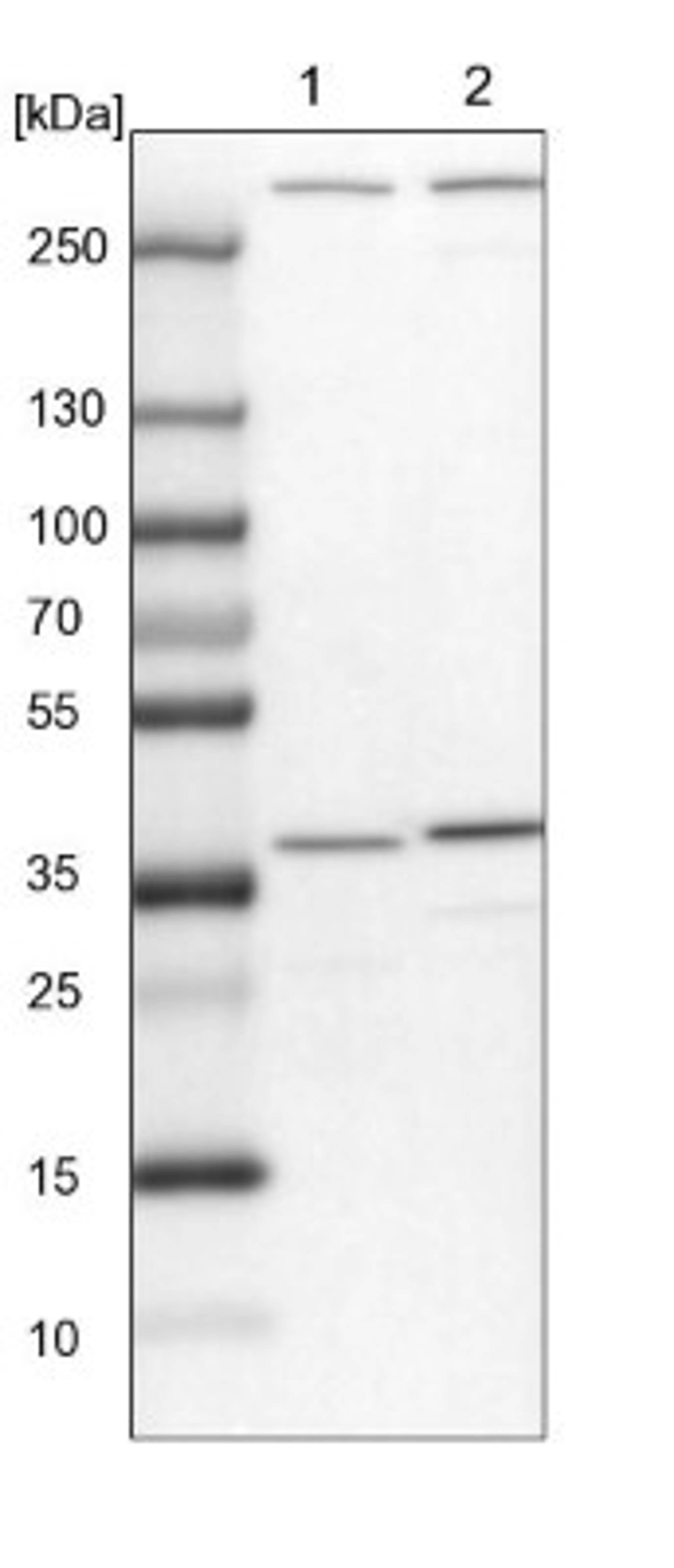 Western Blot: SNX11 Antibody [NBP1-85825] - Lane 1: NIH-3T3 cell lysate (Mouse embryonic fibroblast cells)<br/>Lane 2: NBT-II cell lysate (Rat Wistar bladder tumour cells)