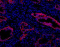 Immunohistochemistry: Oval Cell Marker Antibody (MIC1-1C3) [NBP1-18961] - Immunohistochemical analysis of DDC treated mouse liver.